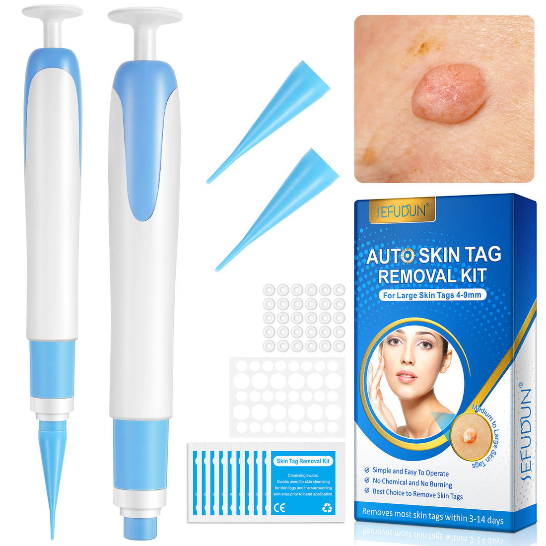 At-Home Skin Tag Remover